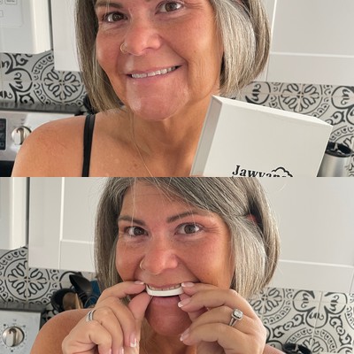 Jawvana customer unboxing and molding the Smart Guard